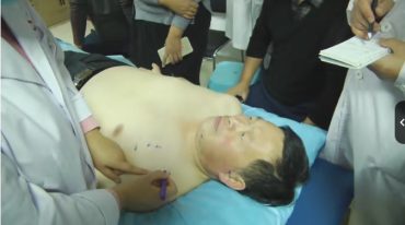 赵新娜主讲-针刀医学精准体表定位